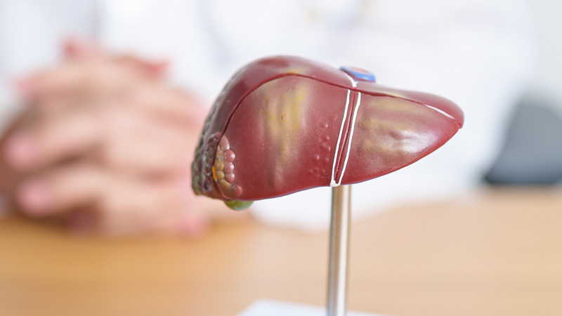 metástases-hepaticas TUMORES DE FÍGADO